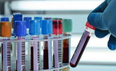 Sanità: Fp, bene ministro Grillo su medicina generale